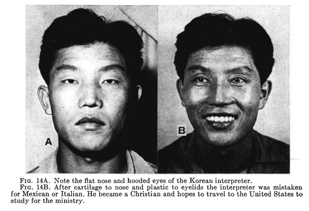 A picture of the same man shown before and after plastic surgery.